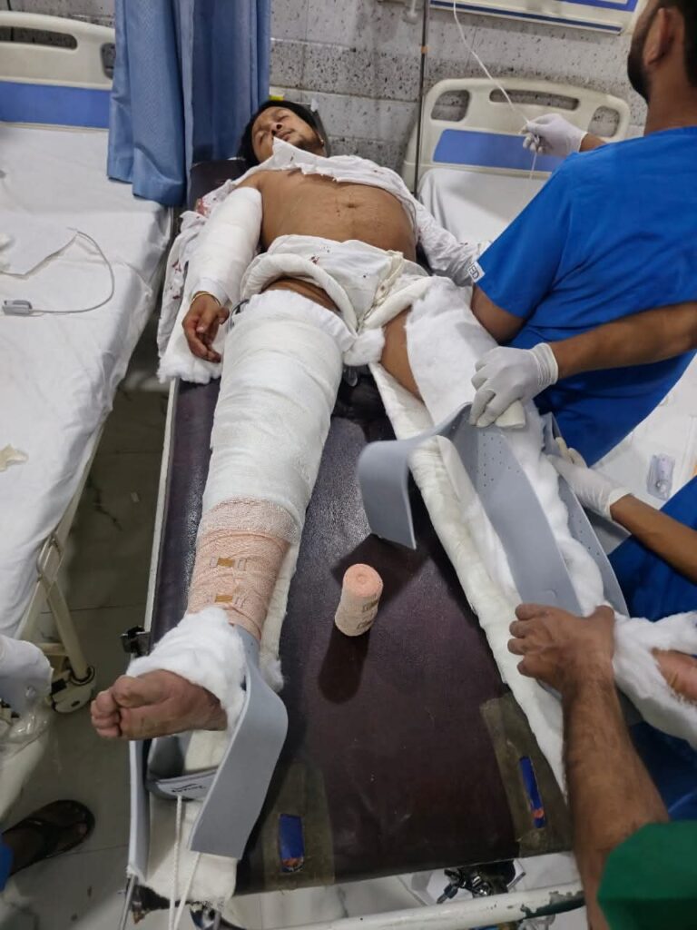 इंडियन आइडल 12 के विजेता पवनदीप राजन का अहमदाबाद में गंभीर कार एक्सीडेंट, अस्पताल में भर्ती 2 1000184184